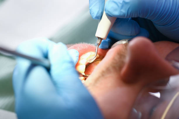 Best Emergency Dental Care for Broken or Chipped Teeth in Payne, OH