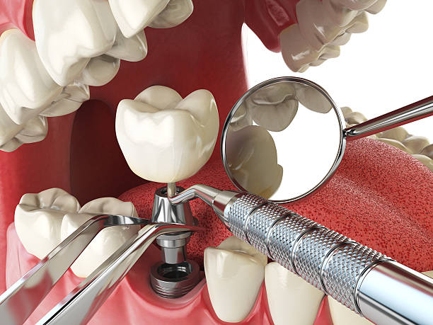 Best Emergency Gum Treatment in Payne, OH